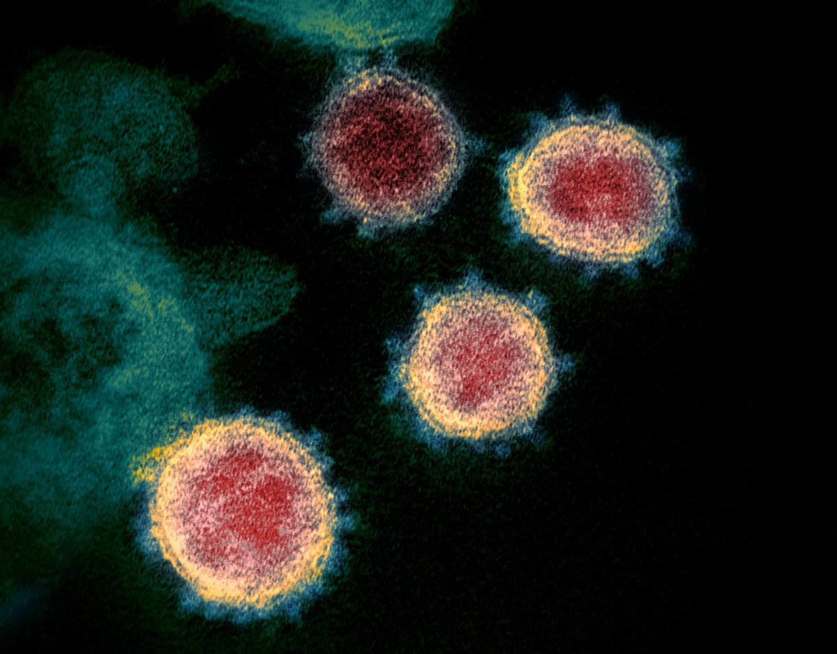 A origem de novos vírus: A COVID-19 e outras histórias